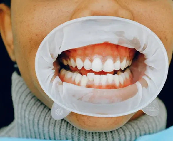 How To Get Gum Pain Relief