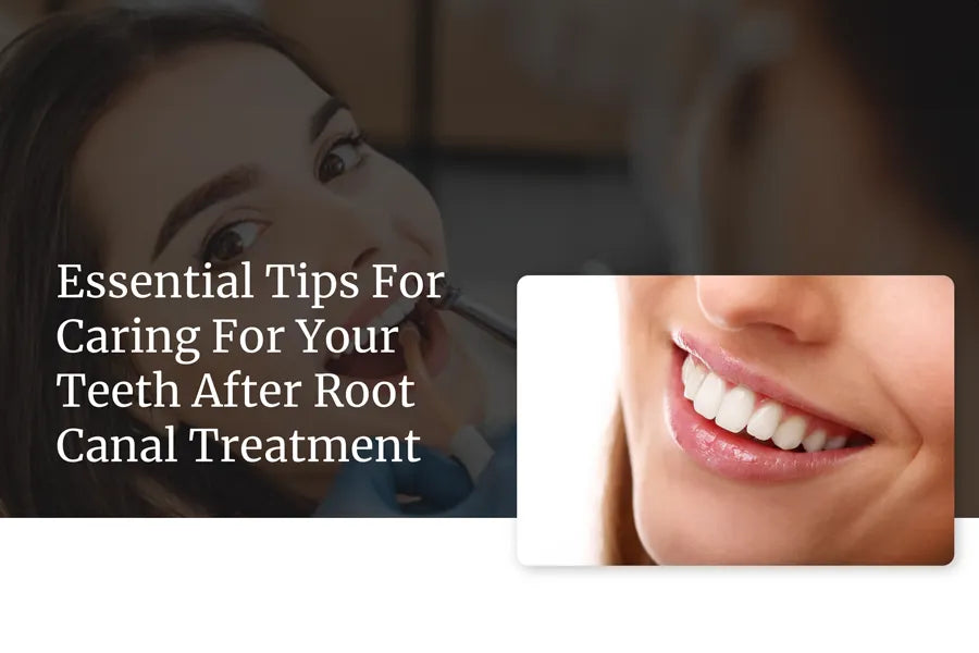 Essential Tips For Caring For Your Teeth After Root Canal Treatment