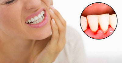 These 5 Easy Tips Can Help Anyone Improve Their Gums