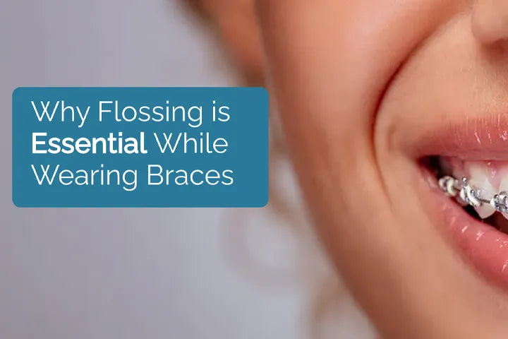 The Importance of Flossing with Braces: Tips for Parents & Kids